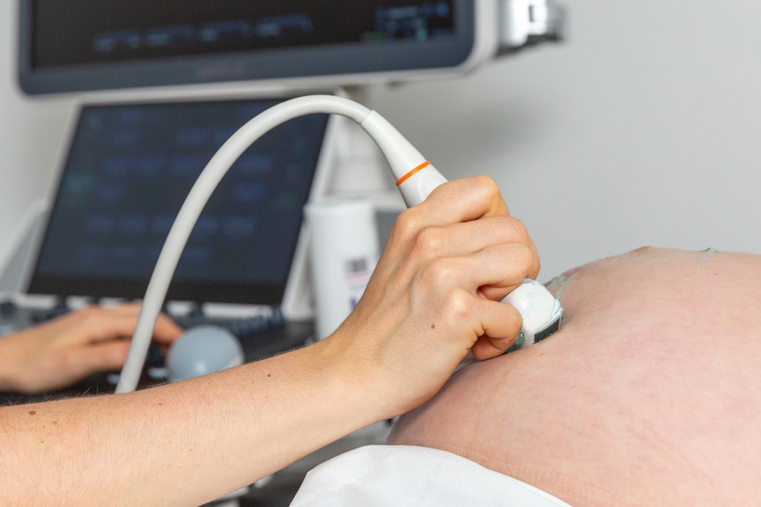 Sonographer performing a 3D/4D scan on a pregnant woman’s belly at Yorkshire Baby Scan