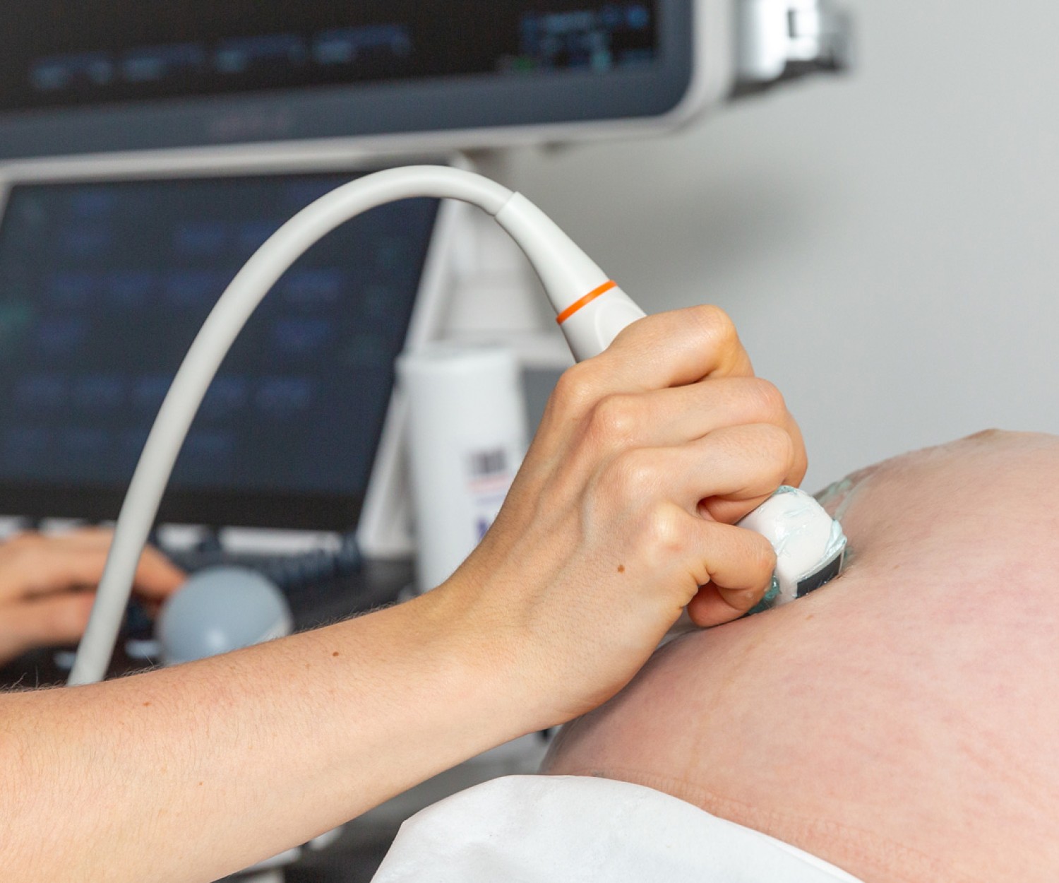 Sonographer performing a 3D/4D scan on a pregnant woman’s belly at Yorkshire Baby Scan