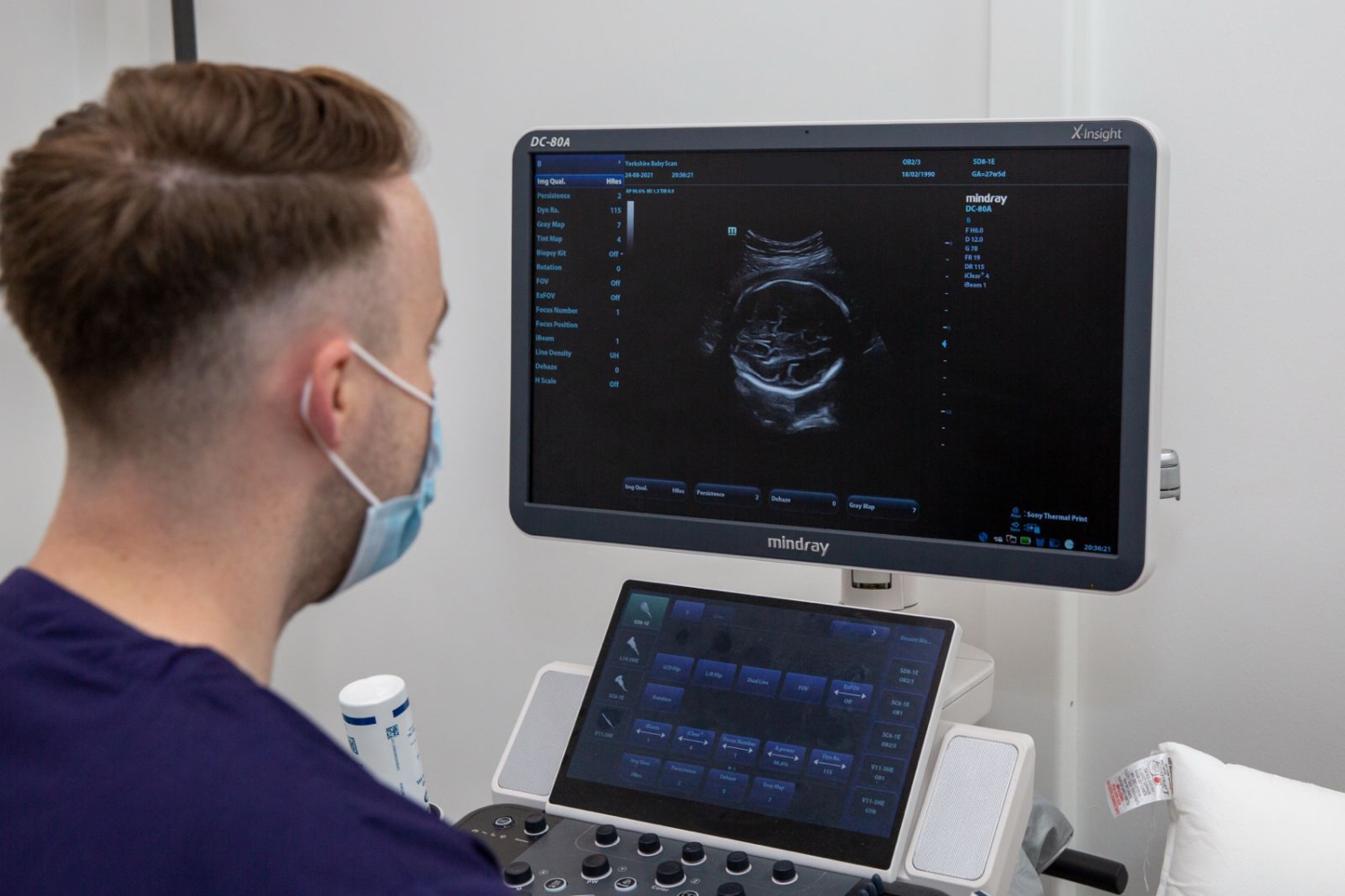 Sonographer performing an ultrasound baby scan and NIPT consultation at Yorkshire Baby Scan clinic.