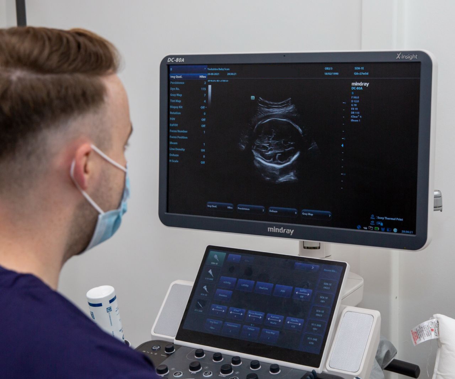 Sonographer performing an ultrasound baby scan and NIPT consultation at Yorkshire Baby Scan clinic.